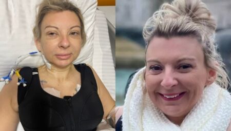 İngiliz bayanın Türkiye’deki estetik kâbusu: ‘Kendimi ikiye ayrılacak üzere hissediyorum’