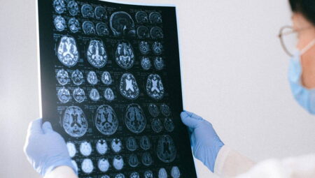 Alzheimer’a virüsler mi yol açıyor?